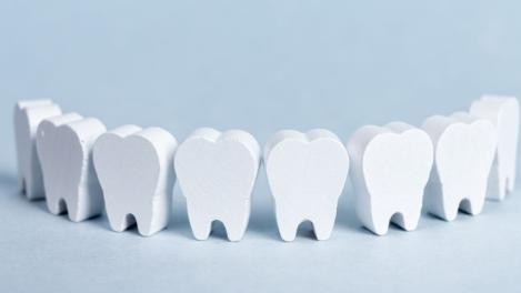 M'T dents, c'est quoi ? 